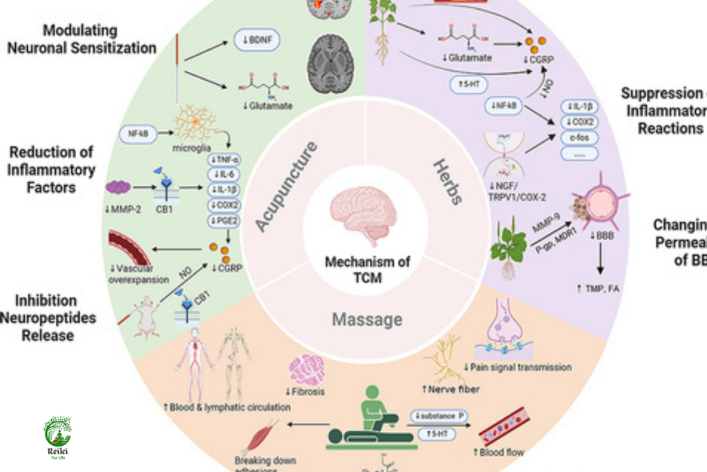 The Role of Chinese Herbal Medicine in Brain AVM