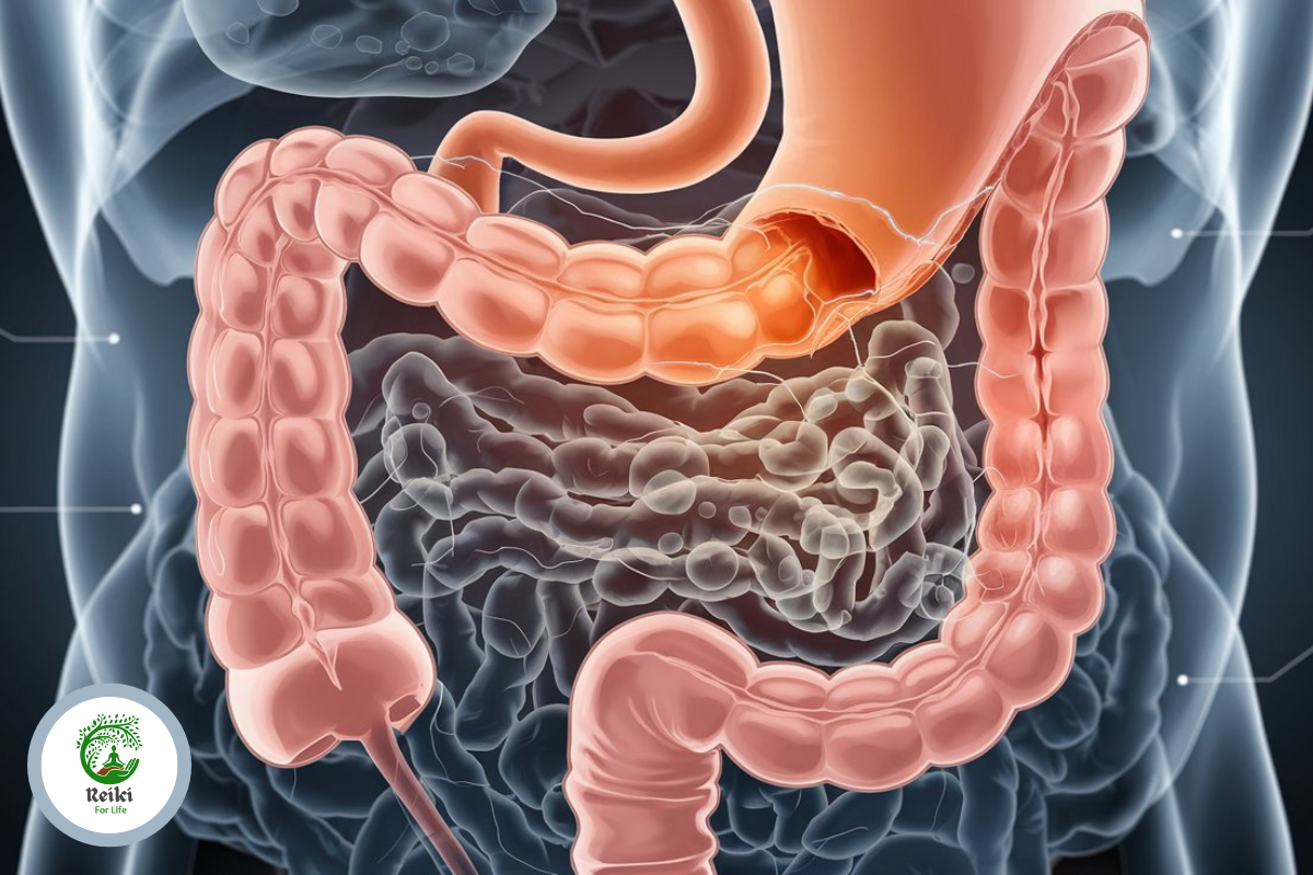 Bowel Cancer Stomach Noises: Causes, Symptoms, and When to Seek Help - Reiki for Life